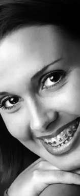 Perfect Smile Orthodontic Smile